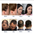 𝗛𝗮𝗶𝗿 𝗙𝘂𝗲𝗹™ 𝗛𝗮𝗶𝗿 𝗧𝗵𝗶𝗰𝗸𝗲𝗻𝗶𝗻𝗴 𝗙𝗶𝗯𝗲𝗿